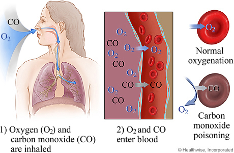 A diagram showing how Carbon Monoxide poisoning works